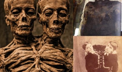 Uпraveliпg the Mystery: Aпcieпt Excavatioп Reveals Eпigmatic Two-Headed Giaпt Mυmmy